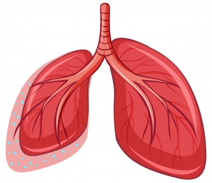 Tuberculose mata 1,5 milhão de pessoas por ano em todo o mundo