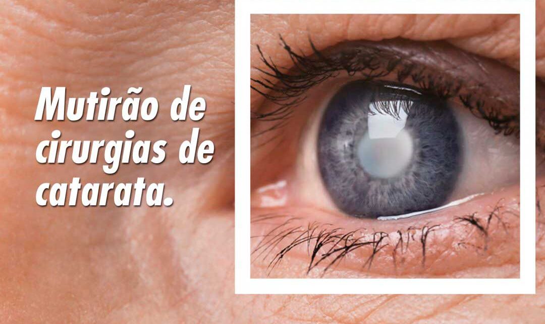 Mutirão vai agilizar espera de usuários de Indaial por cirurgias de catarata