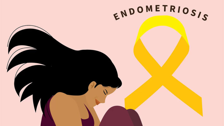 Março Amarelo na Luta contra a endometriose