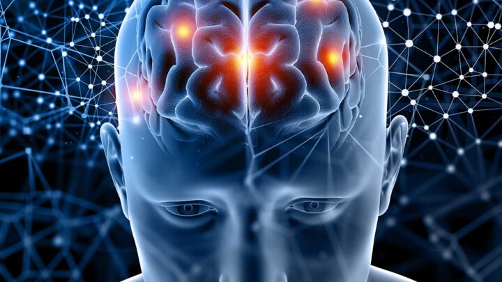 Neurologista desvenda mitos sobre epilepsia e destaca medidas preventivas para gerenciar a condição de forma eficaz
