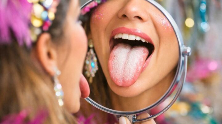 Você está com a língua branca? Do BBB ao Carnaval: entenda o que essa condição revela sobre a saúde bucal